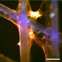 stem cells on MEW disk thumbnail