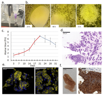 Teil von Abb. 3.: Charakteristik eines neuen bioprinted 3D-Gewebe- Modells von menschlichen Krebszellen ZR75.1. (a) Zwei einzeln betriebene Extruder für die Herstellung von 3D-bioprinted Strukturen für die Gewebemodellierung.